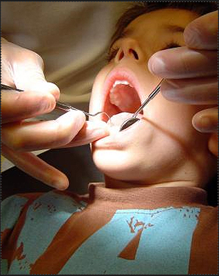Dental Instruments